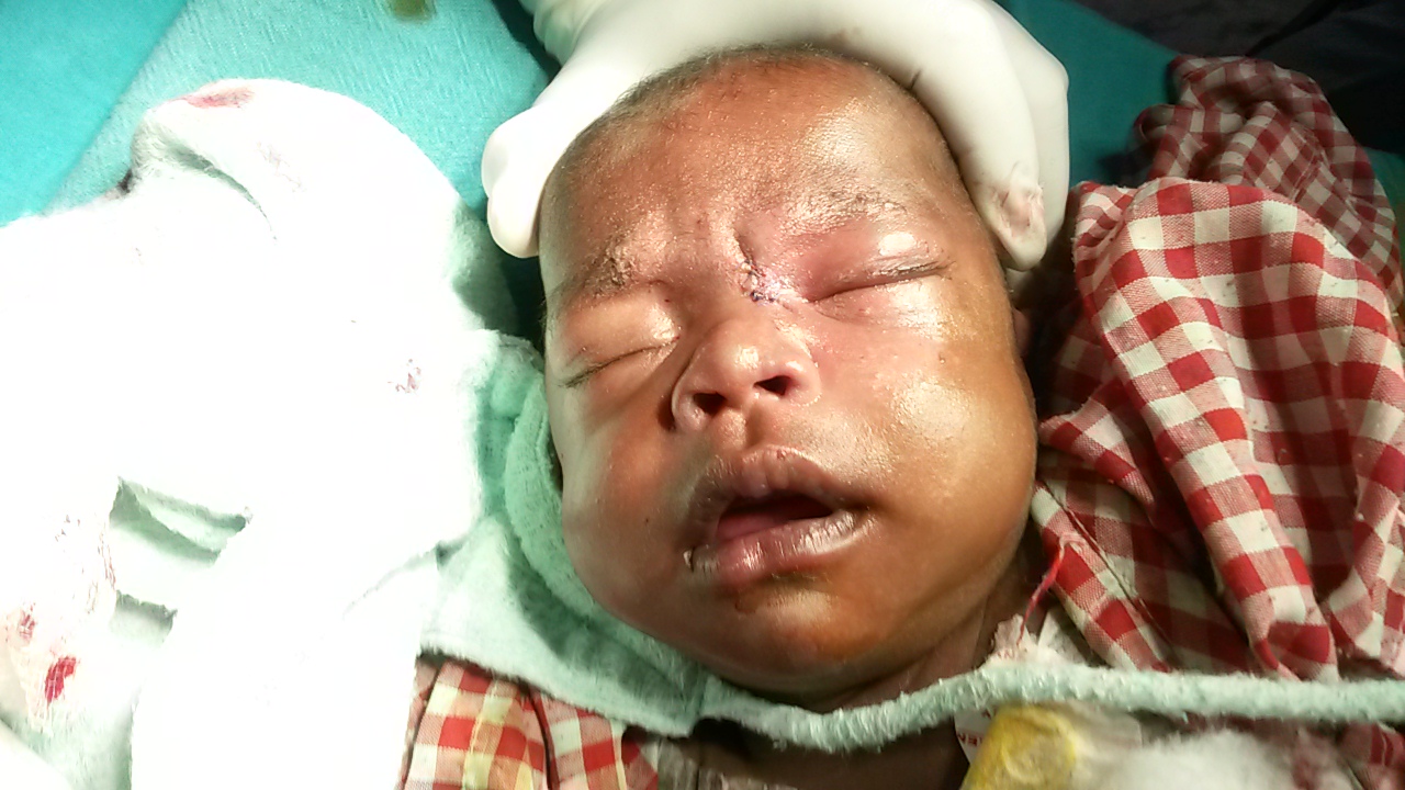 Pediatric Plastic Surgery Image 4